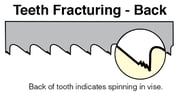 Teeth-Fracturing
